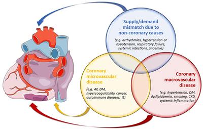 Myocardial Infarction With Non-obstructive Coronary Arteries: Risk Factors and Associated Comorbidities